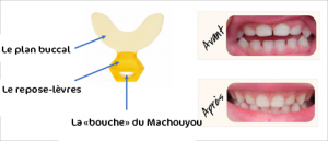 positionnement de la langue machouyou